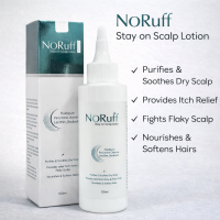 Noruff Stay on Scalp Lotion