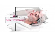 Acne Treatment  (24)
