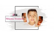 Melasma Treatment (9)