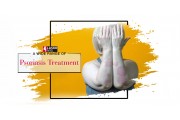 Psoriasis Treatment  (3)