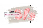 Scabies Treatment  (5)