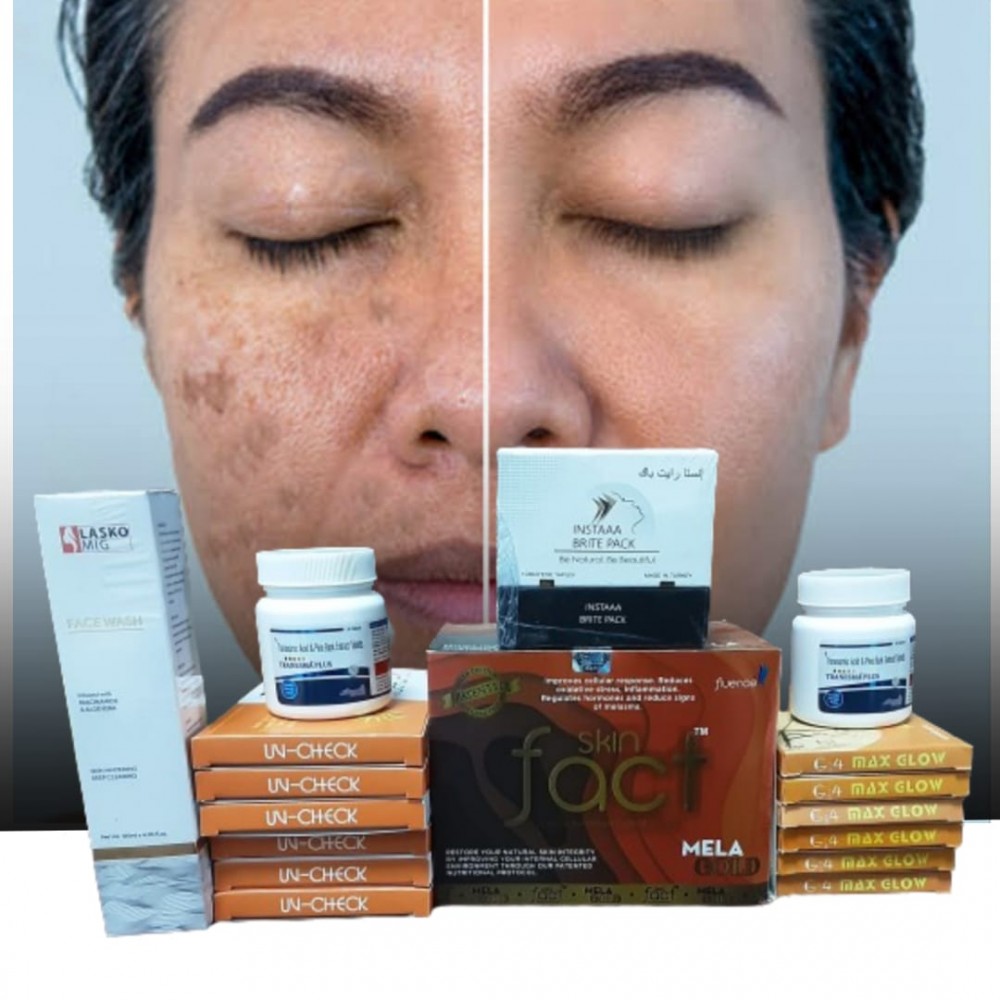 Melasma Treatment kit
