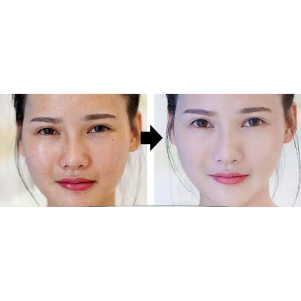Sample Whitening Cream