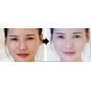 Sample Whitening Cream