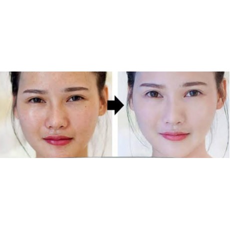 Sample Whitening Cream