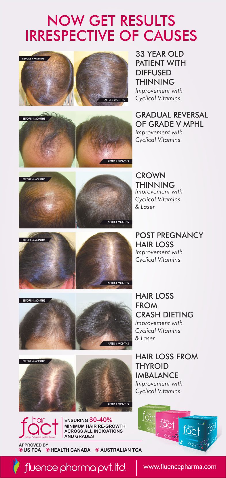 Male Hair Fact Kit India 100% result oriented Advanced Cyclical Therapy